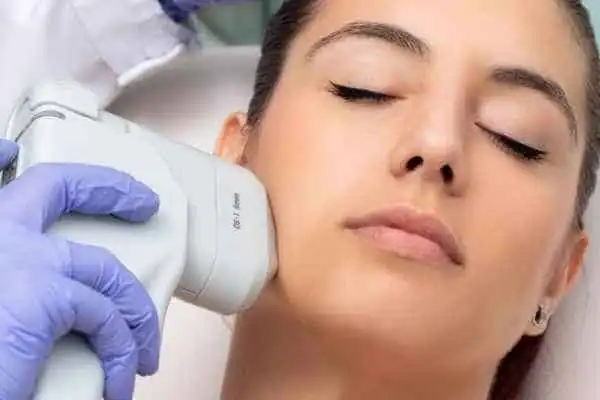 Image of woman having HIFU Buxton treatment