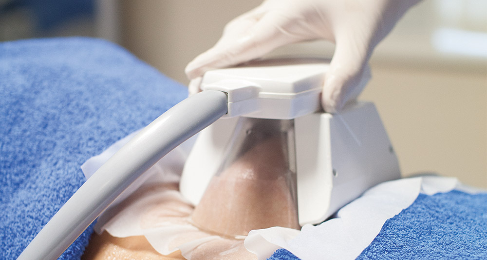 How Fat Freezing and HIFU Work Together? 2 Multiple Areas in One Session HIFU and Fat Freezing Buxton