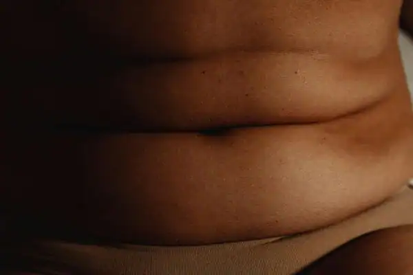 The Hidden Connection: How Stress Shapes Your Fitness and Body Composition 3 image of what stress can do on the stomach area and how Lipo 360 Buxton can help to change your body shape.
