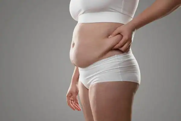 Image of stress belly Buxton How Lipo 360 can help manage your symptoms